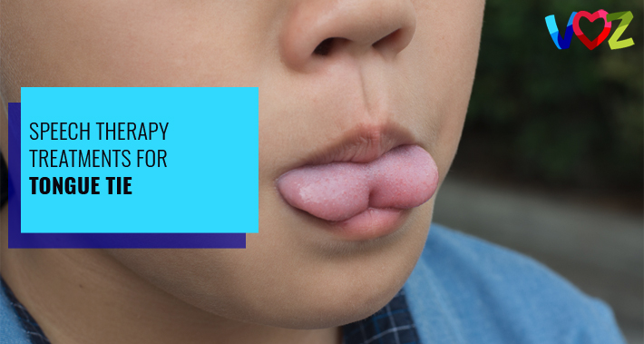Speech Therapy Treatments For Tongue Tie | Voz Speech Therapy Clinic Washington DC