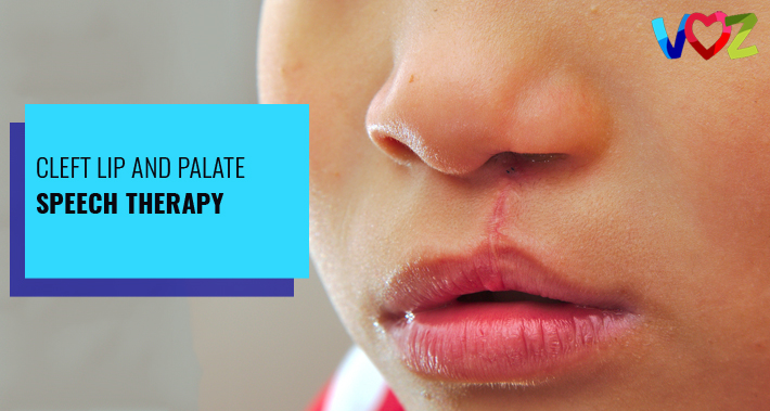 Cleft Lip and Palate Speech Therapy | Voz Speech Therapy Clinic Washington DC